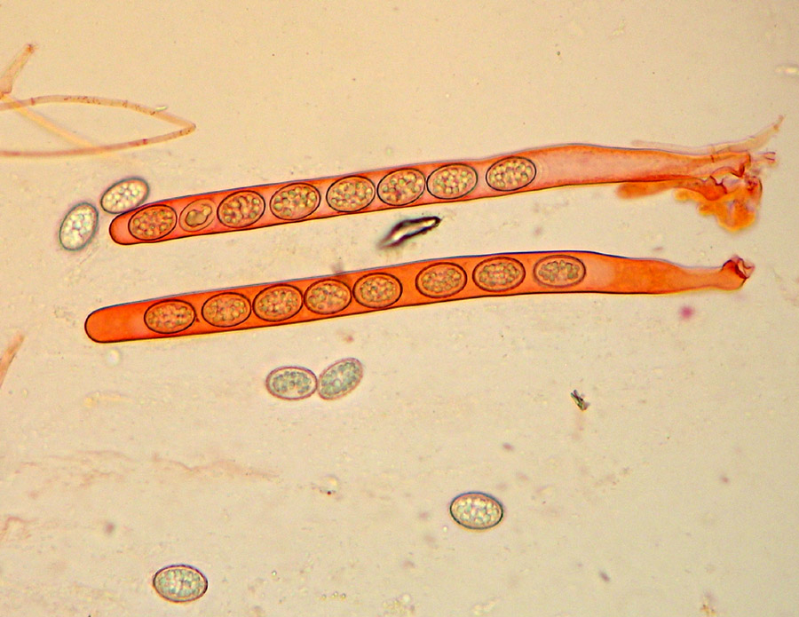 Scutellinia sp